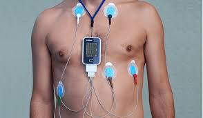 Holter de ritmo