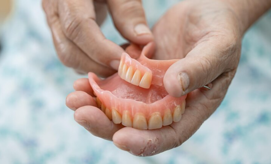 Prótesis dentales